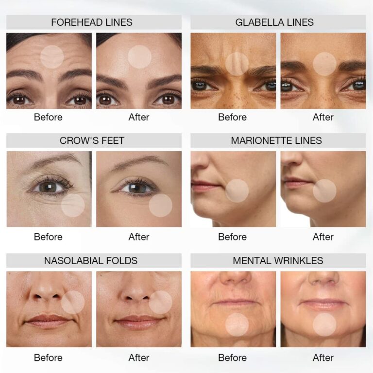 7 Colors LED Face Mask Light Therapy Review