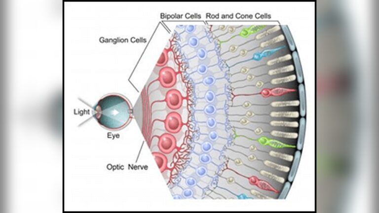Can Led Lights Cause Ocular Migraines